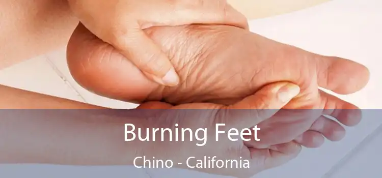 Burning Feet Chino - California