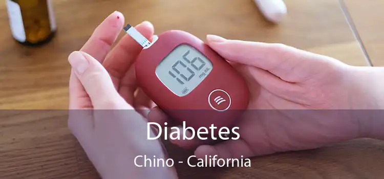 Diabetes Chino - California