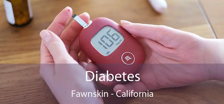 Diabetes Fawnskin - California