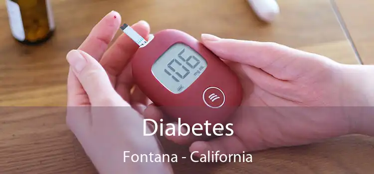 Diabetes Fontana - California