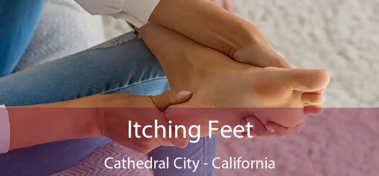 Itching Fееt Cathedral City - California