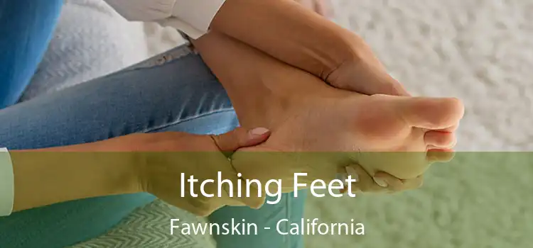 Itching Fееt Fawnskin - California