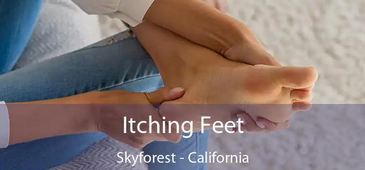 Itching Fееt Skyforest - California