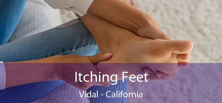 Itching Fееt Vidal - California